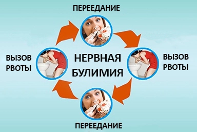 Лечение булимии в Кстово